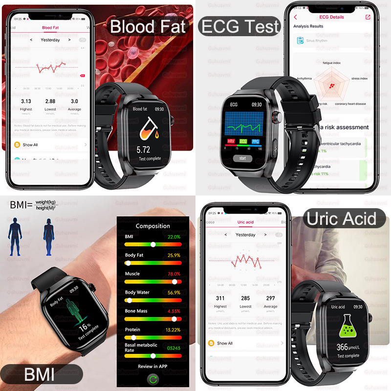 Jam Tangan Pintar Presisi Ting - Smartwatch New Watches 2025 ulasan dan harga